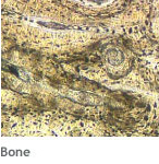 Regenerative Medicine: Bone tissue